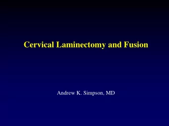 Cervical Laminectomy and Fusion  Andrew K. Simpson, MD  Cervical Laminectomy and Fusion  The best