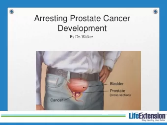 Development  By Dr. Walker  Objectives  The many faces of prostate cancer?  Discuss the