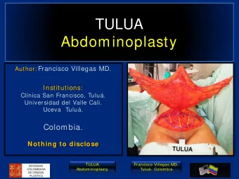 TULUA  Abdominoplasty Author: Francisco Villegas MD.  Institutions:  Clnica San Francisco,