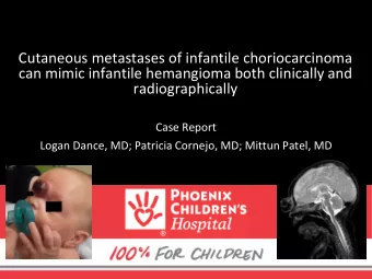 can mimic infantile hemangioma both clinically and  radiographically  Case Report  Logan Dance, MD;