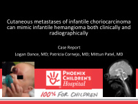 can mimic infantile hemangioma both clinically and