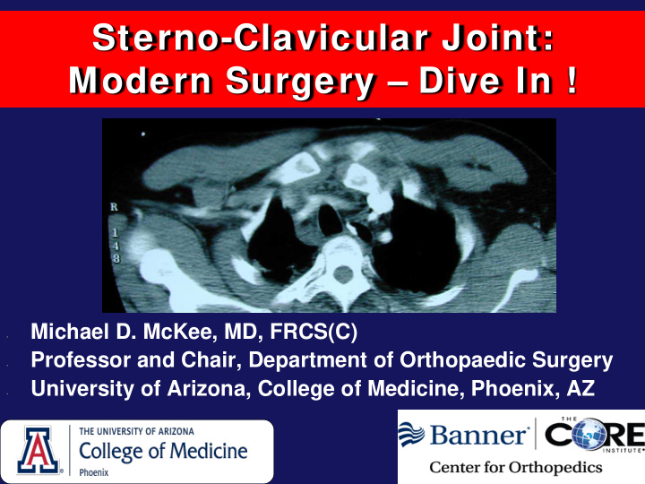 sterno clavicular joint modern surgery dive in