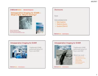 Intraoperative Imaging for EVAR  What's New, What's Coming?  None  Acknowledgements  Matt