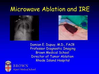 Microwave Ablation and IRE  Damian E. Dupuy, M.D., FACR  Professor Diagnostic Imaging  Brown