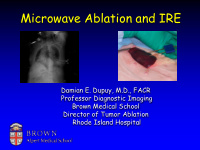 microwave ablation and ire
