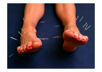 Helping poor performing  Helping poor performing  nurses reach competence  nurses reach competence