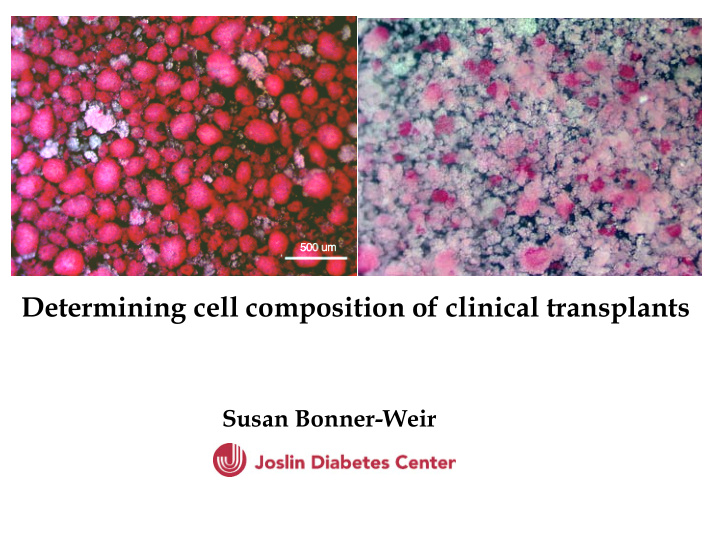 determining cell composition of clinical transplants