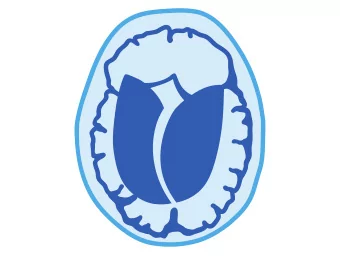 Development and Evaluation of AI-based  Parkinsons Disease Related Motor Symptom  Detection