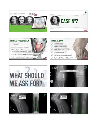 WHAT SHOULD  WE ASK FOR?  X-RAYS  X-RAYS  9 anterior  9 anterior  Tibial slope  Tibial slope