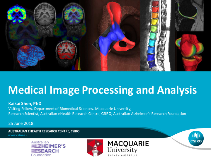 medical image processing and analysis
