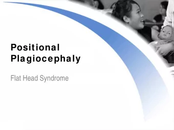 Positional  Plagiocephaly  Flat Head Syndrome  Positional  Plagiocephaly  Also known as flat
