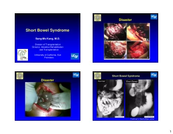 Short Bowel Syndrome  Sang-Mo Kang, M.D.  Division of Transplantation  Director, Intestinal