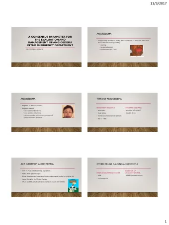 11/3/2017  ANGIOEDEMA  A CONSENSUS PARAMETER FOR  THE EVALUATION AND  is a physical sign