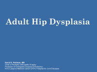 adult hip dysplasia