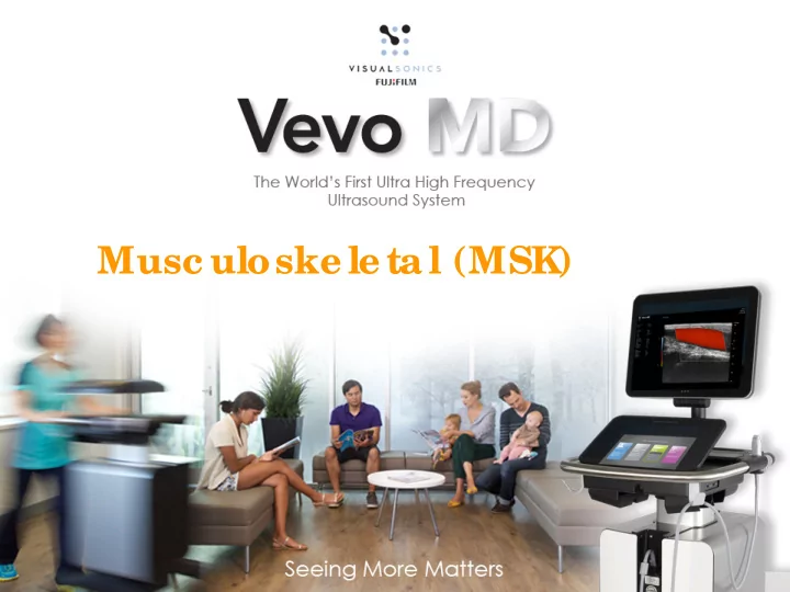 musc uloske le ta l msk outline