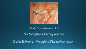 Critical care nurse  Patient  Chronic Lyme Disease and Morgellons  Dr. Virginia Savely  &quot;I