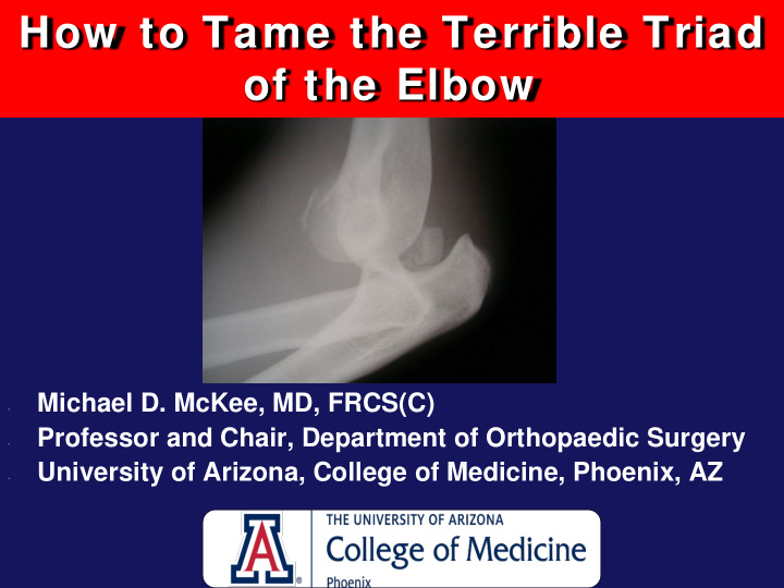 how to tame the terrible triad of the elbow