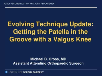 Evolving Technique Update:  Getting the Patella in the  Groove with a Valgus Knee  Michael B.