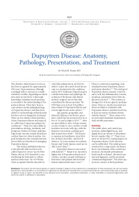 dupuytren disease anatomy pathology presentation and