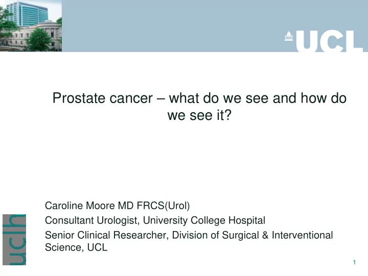 prostate cancer what do we see and how do we see it