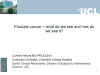 prostate cancer what do we see and how do we see it