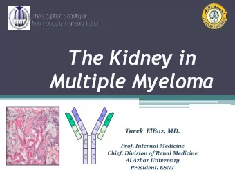 The K  Kidney in  Mult  ultiple  le M  Myelo  loma  ma  Tarek  ElBaz, MD.  Prof. Internal Medicine