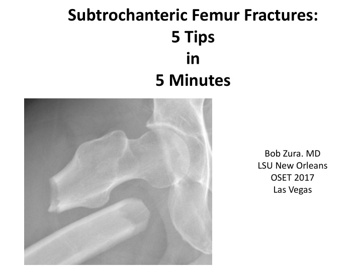 subtrochanteric femur fractures 5 tips in 5 minutes