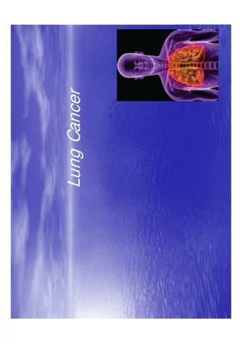 Lung Cancer  Objectives  To provide a general overview of lung physiology  To explore the types and