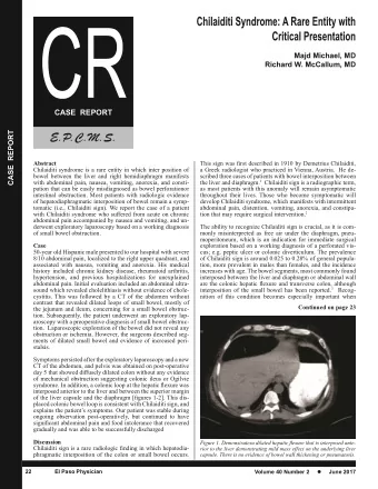 CASE  REPORT  Abstract  This sign was first described in 1910 by Demetrius Chilaiditi,  Chilaiditi