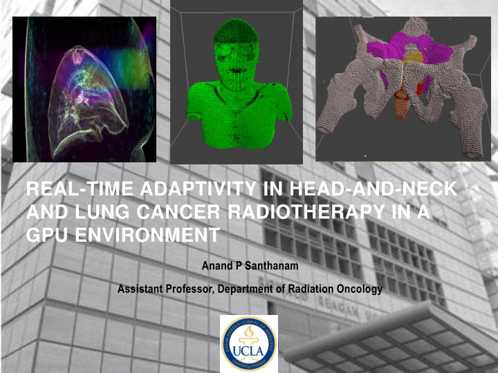 real time adaptivity in head and neck and lung cancer