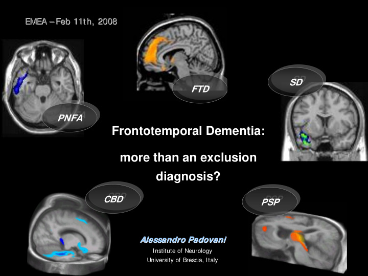 frontotemporal dementia more than an exclusion diagnosis