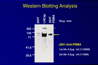 Western Blotting Analysis  LNCap  PSMA  293T  293T 20 m g / lane  202  133  71  J591:Anti-PSMA