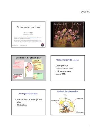 Glomerulonephritis notes ! Neil Turner ! University of Edinburgh !  Notes to  accompany online