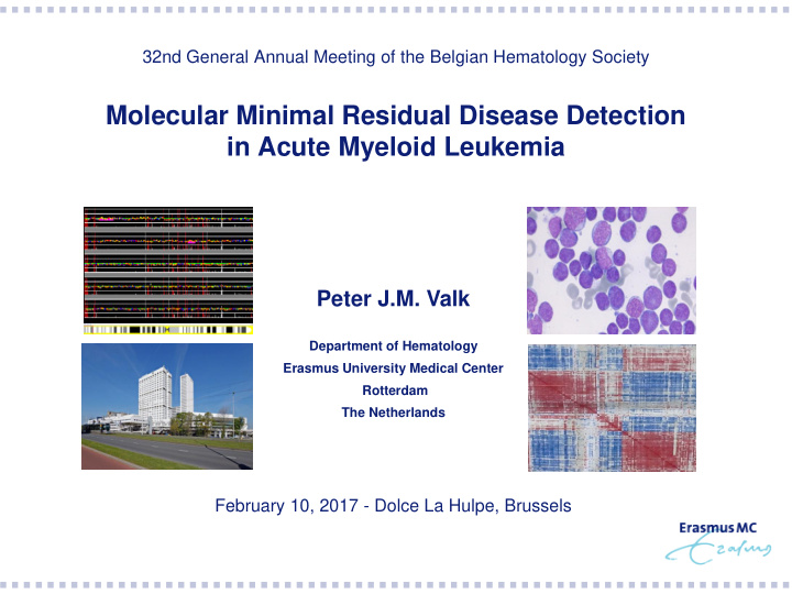 molecular minimal residual disease detection in acute