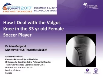 How I Deal with the Valgus  Knee in the 33 yr old Female  Soccer Player  Dr Alan Getgood  MD MPhil