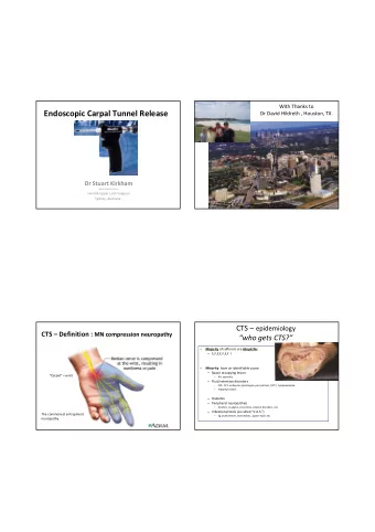 Endoscopic Carpal Tunnel Release  Dr David Hildreth , Houston, TX.  Dr Stuart Kirkham  MBBS FRACS