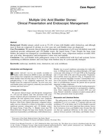 B ladder urinary calculi are usually secondary to  cystoscope with settings of 1.0 J and 10 Hz at