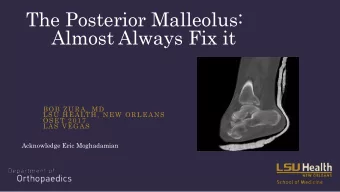 The Posterior Malleolus:  Almost Always Fix it  BOB ZURA, MD  LSU HEALTH, NEW ORLEANS  OSET 2017