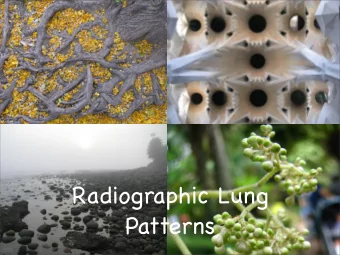 Radiographic Lung  Patterns  Systematic approach  heart  mediastinum  vessels  lungs  pleural space