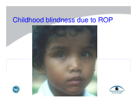 childhood blindness due to rop childhood blindness due to