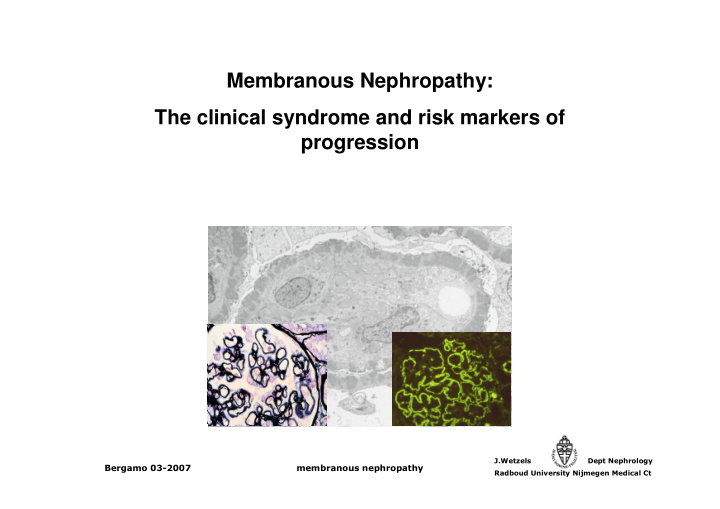 membranous nephropathy the clinical syndrome and risk