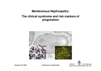 Membranous Nephropathy:  The clinical syndrome and risk markers of  progression