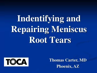Indentifying and  Repairing Meniscus  Root Tears  Thomas Carter, MD  Phoenix, AZ  Meniscal Root