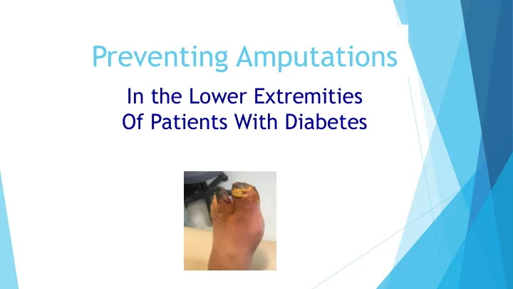 preventing amputations