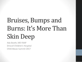 Bruises, Bumps and  Burns: Its More Than  Skin Deep  Ada Booth, MD FAAP  Driscoll Childrens