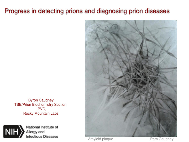progress in detecting prions and diagnosing prion diseases