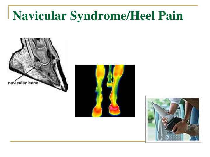 navicular syndrome heel pain navicular syndrome heel pain