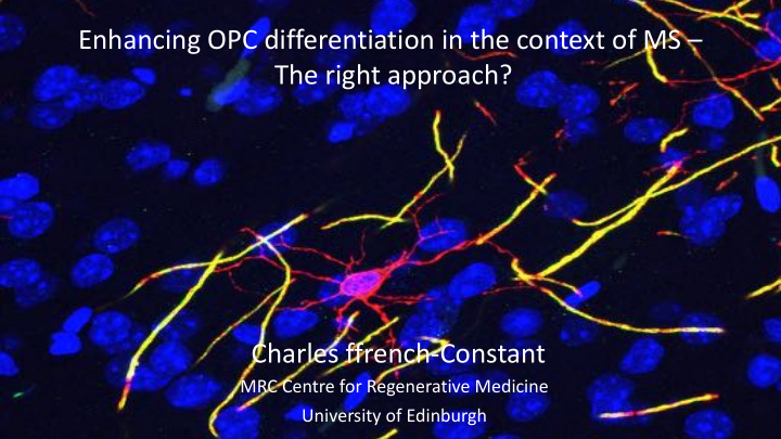 enhancing opc differentiation in the context of ms the