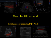 vascular ultrasound