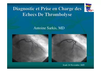Diagnostic et Prise  Prise en Charge des  en Charge des  Diagnostic et  Echecs De Thrombolyse  De